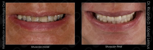 Ricardo López Lemus-91