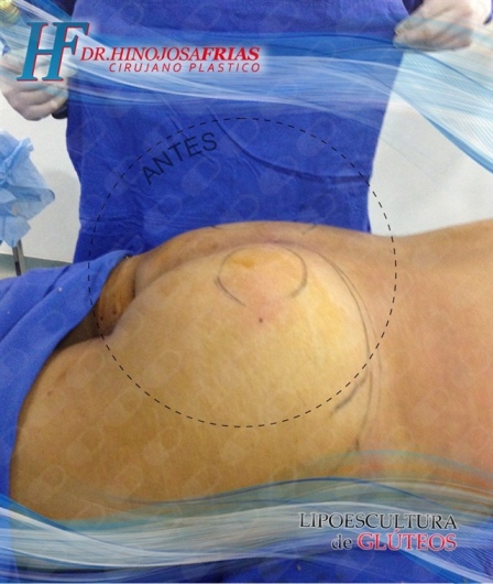 Miguel Ángel Hinojosa Frías-19