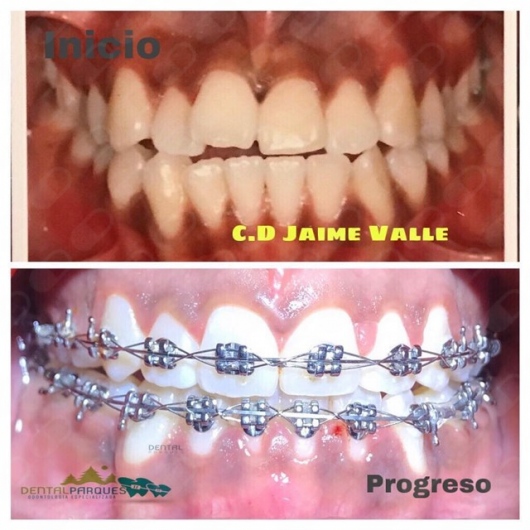 Jaime Valle Ledesma-10