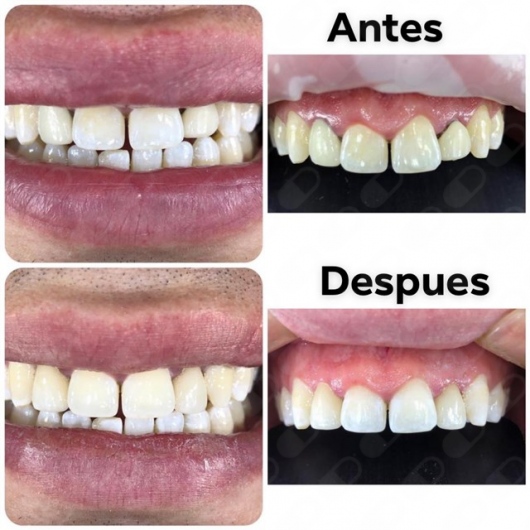 Alejandro Uribe Marioni-13