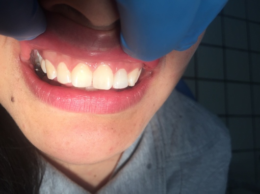 Arturo Romero Grande-35