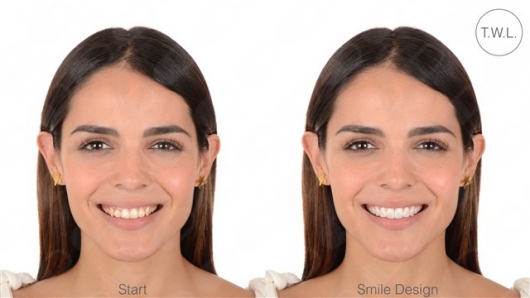 Christian Álvarez-11