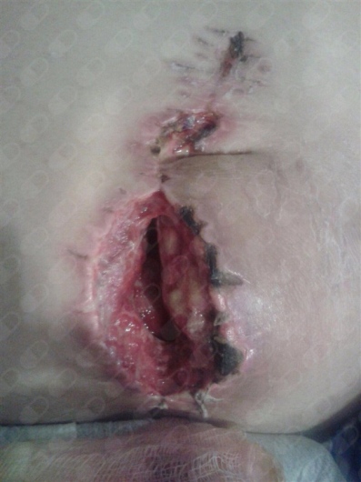 Angel Manuel Piña Jaén-5