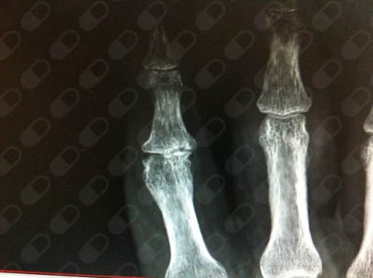 Citlallyc Gómez Ruiz-7