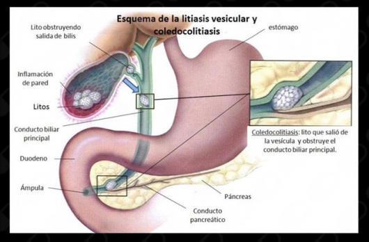Luis Ricardo Olivares De La Fuente-4