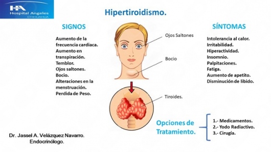 Jassel Velázquez Navarro-8
