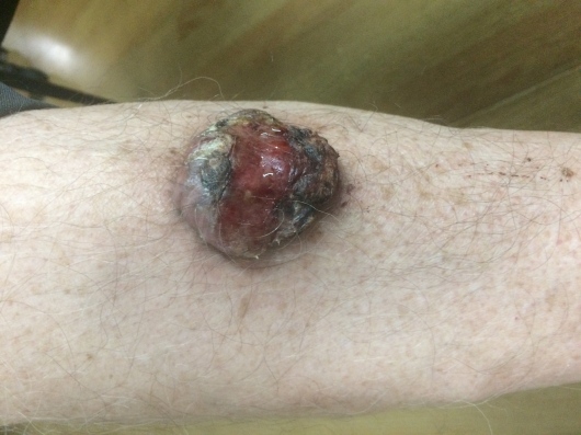 Orieta Herbas Rocha-6