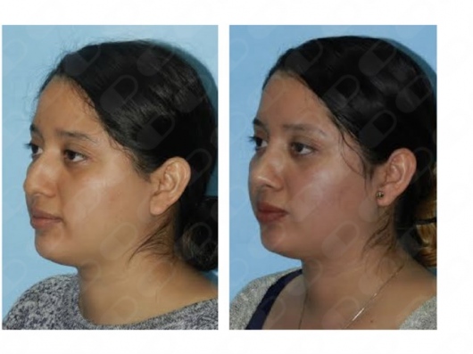 Blanca Santos Mejía-4