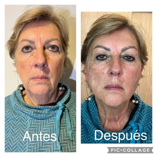 Arturo Romero Grande-22