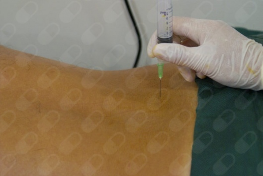 Angel Manuel Piña Jaén-7