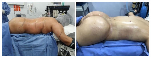 Guillermo Jiménez Labora Irineo-2