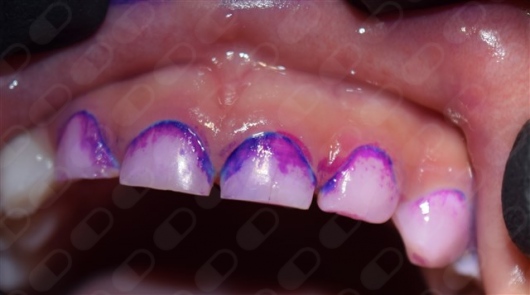 Mariana Beltrán González-6