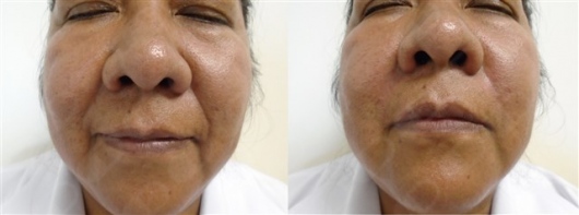 Ismael Cheng Flores-4