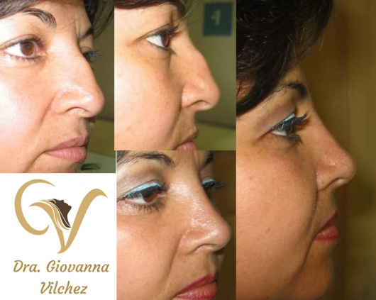 Giovanna Vilchez García-9