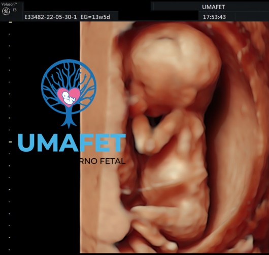 Alejandro Gaspar Vera-1