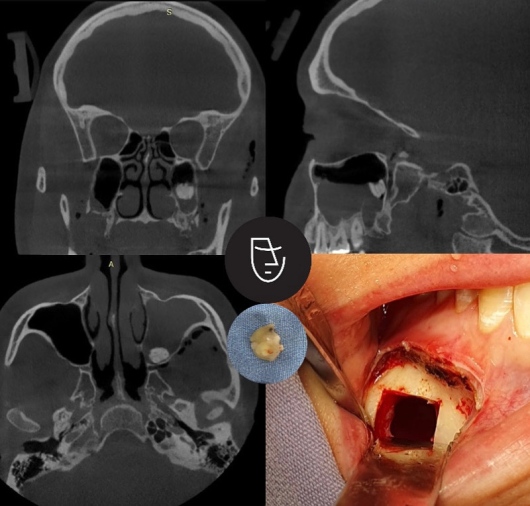 Ayrton Arriola Rivera-6