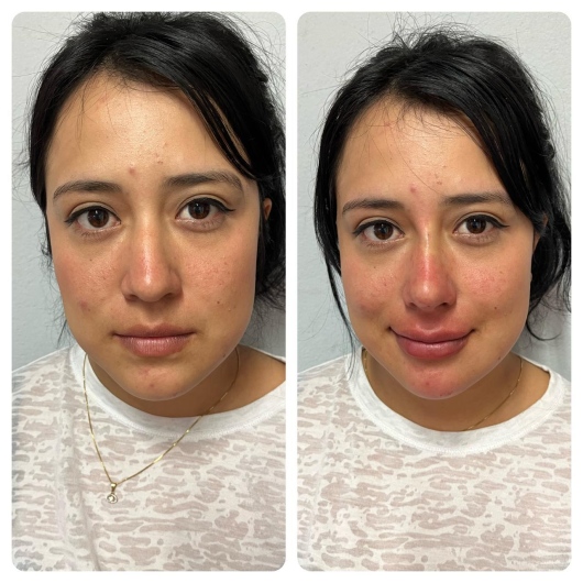 Arturo Romero Grande-7