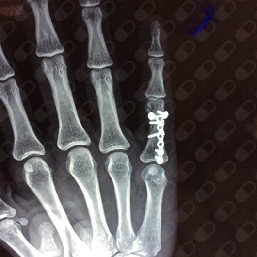 Miguel Angel Hernández Alvarez-6