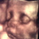 Dra. María Elena Herrera Delgadillo