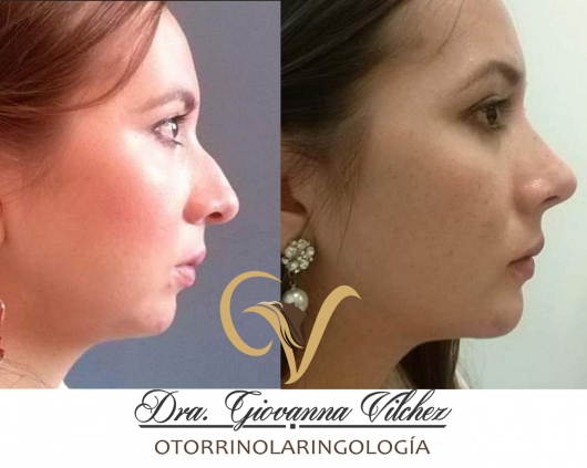 Giovanna Vilchez García-7