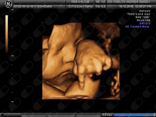 Carlos Andrés Garza Flores-8