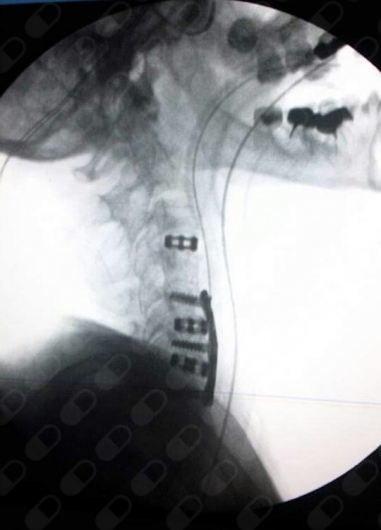 Adrian Aguilera Lorenzini-6