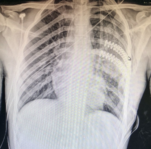 Gildardo Cortes Julian-21