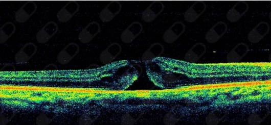 Betsabé Urías Planella-4