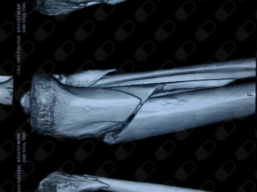 Jose Octavio Andrade Cruz-4