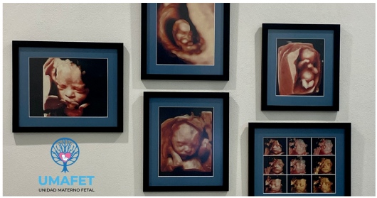 Alejandro Gaspar Vera-5