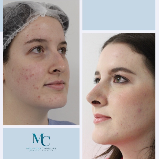 Carlos Mauricio Casillas Ibarra-17