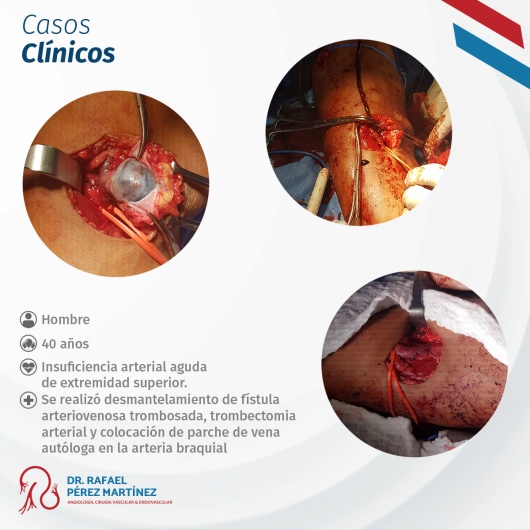 Rafael Pérez Martínez-10