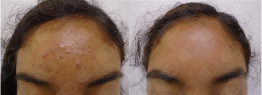 Ismael Cheng Flores-5