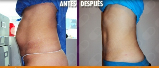 Homero Vite Armenta-3