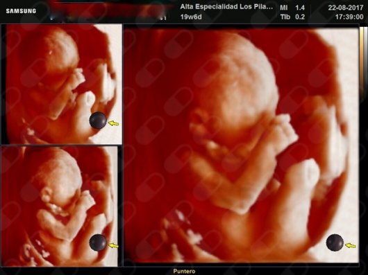 Octavio Herrera Osorio-8