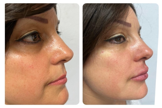 Arturo Romero Grande-11