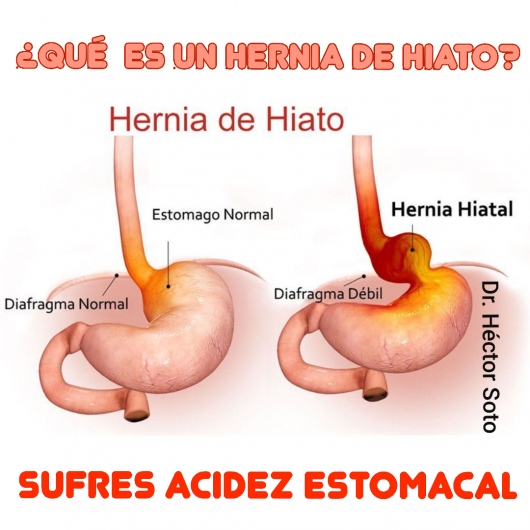 Héctor Soto Mendoza-0