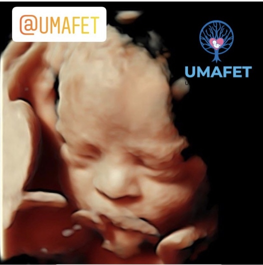 Alejandro Gaspar Vera-9