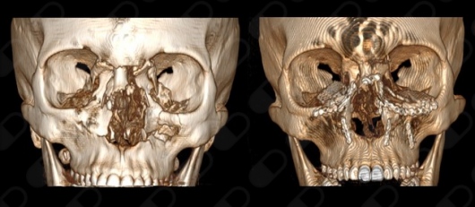 Dayel Gerardo Rosales Díaz Mirón-9