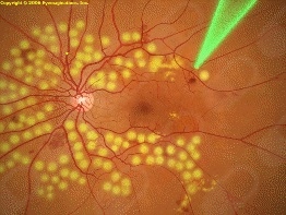 Tania Adabache Guel-10