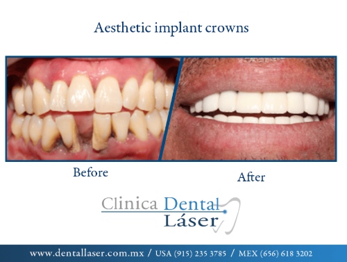 Zonia Edith Barrandey Orozco-0