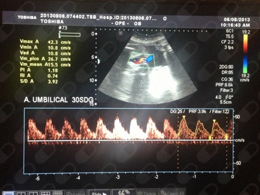 David Omar Gil Navarro-21