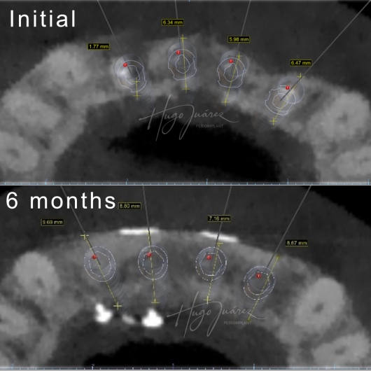 Hugo Juárez César-5