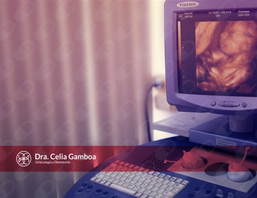 Celia Ivonne Gamboa Altúzar-3