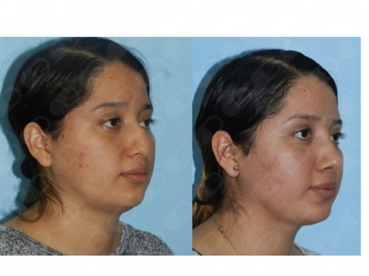 Blanca Santos Mejía-5