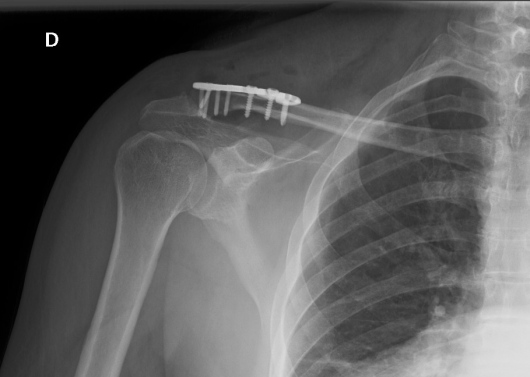 Alejandro Ismael Lopez Atristain-2