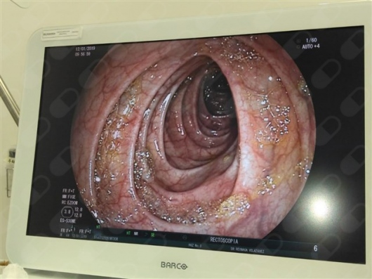 Jose Gpe Reynaga Velazquez-3