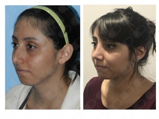 Blanca Santos Mejía-6