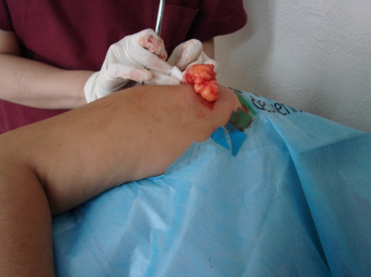 Orieta Herbas Rocha-2