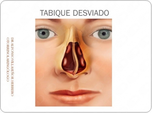 Alfonso Villaseñor Herrero-33